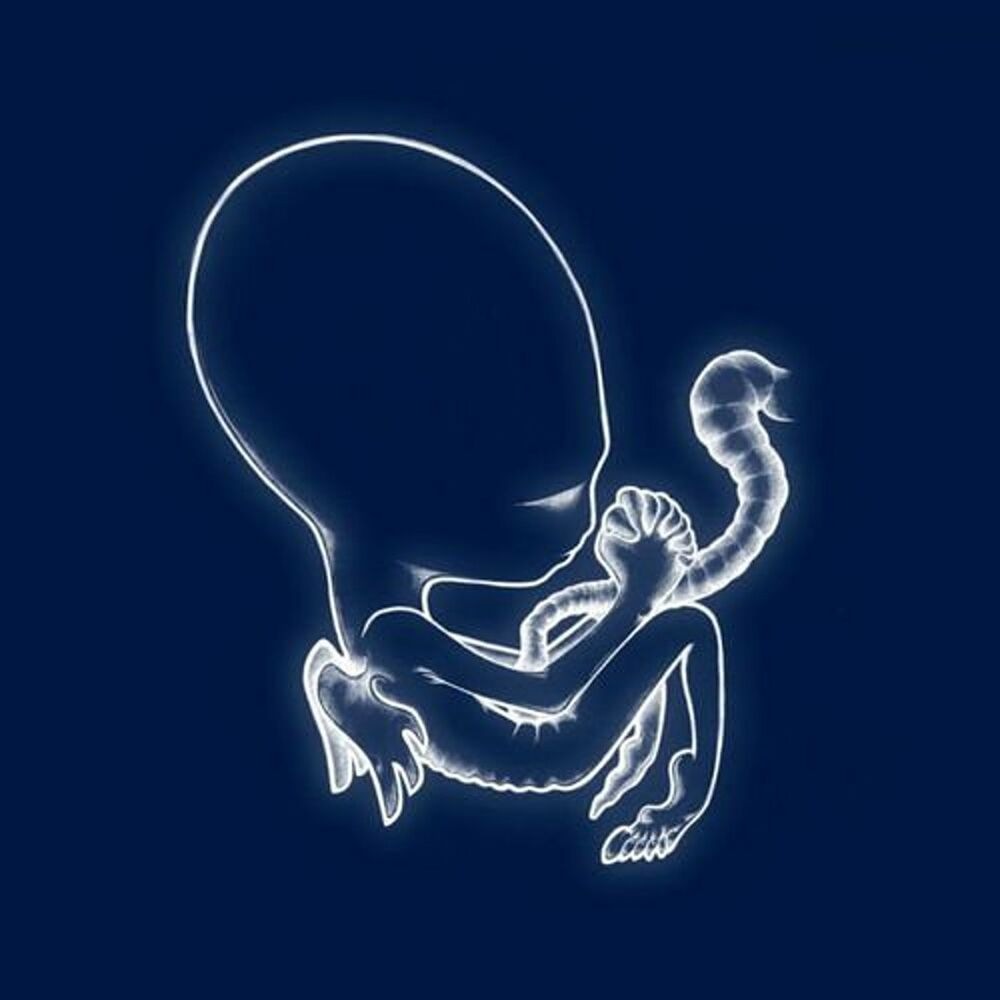 Sigur Rós - Starálfur